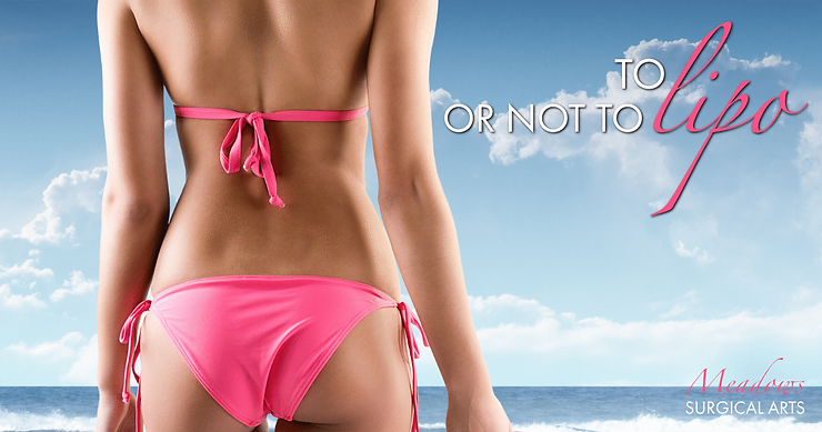 To Lipo, Or Not To Lipo? Top 5 Reasons to Choose Liposuction
