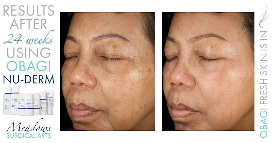 STEP 4 - EXFOLIATE