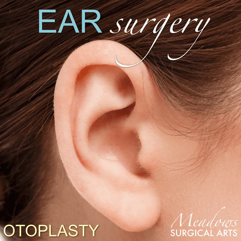 What Is an Otoplasty?
