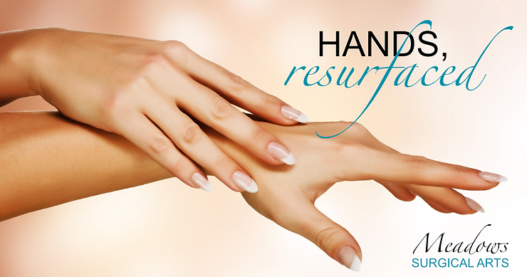 Hands, Resurfaced
