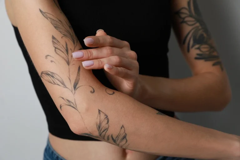 Laser Tattoo Removal