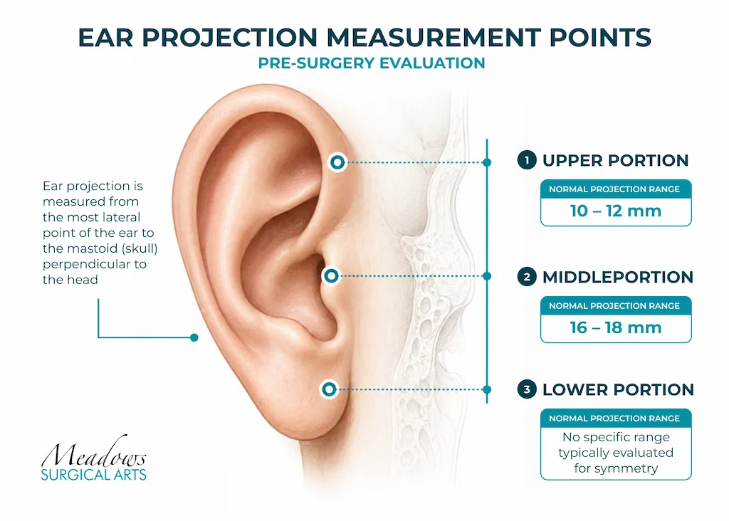 How Do Surgeons Evaluate Your Ears Before Otoplasty?