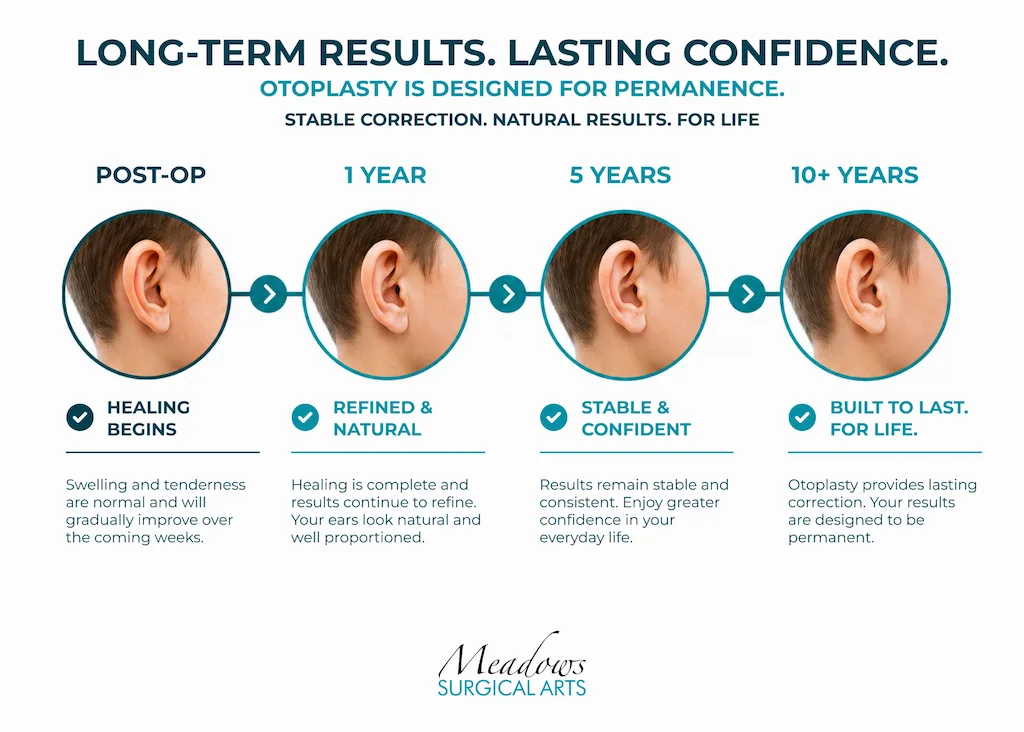 How Long Do Otoplasty Results Last?