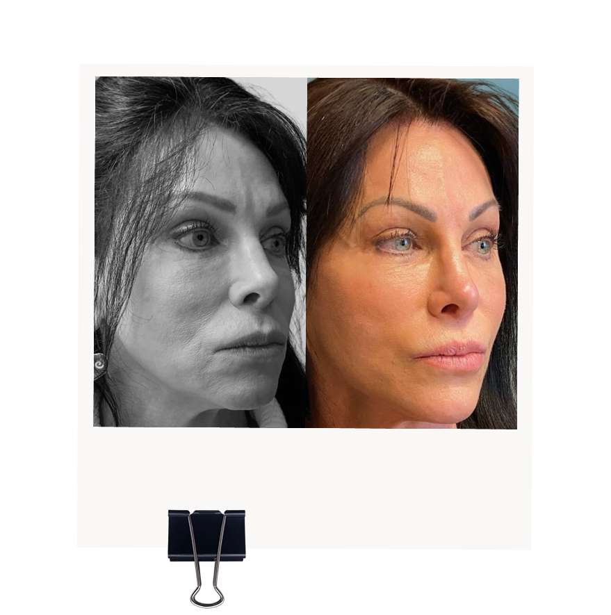 Patient result portrait