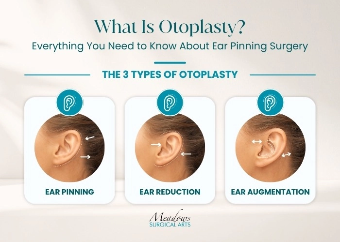 What Are the Different Otoplasty Techniques