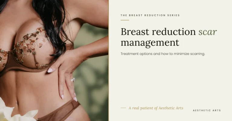 Breast Reduction Scar Care: Treatments That Actually Work