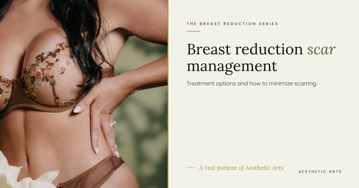 breast reduction scars, real patient of Aesthetic Arts