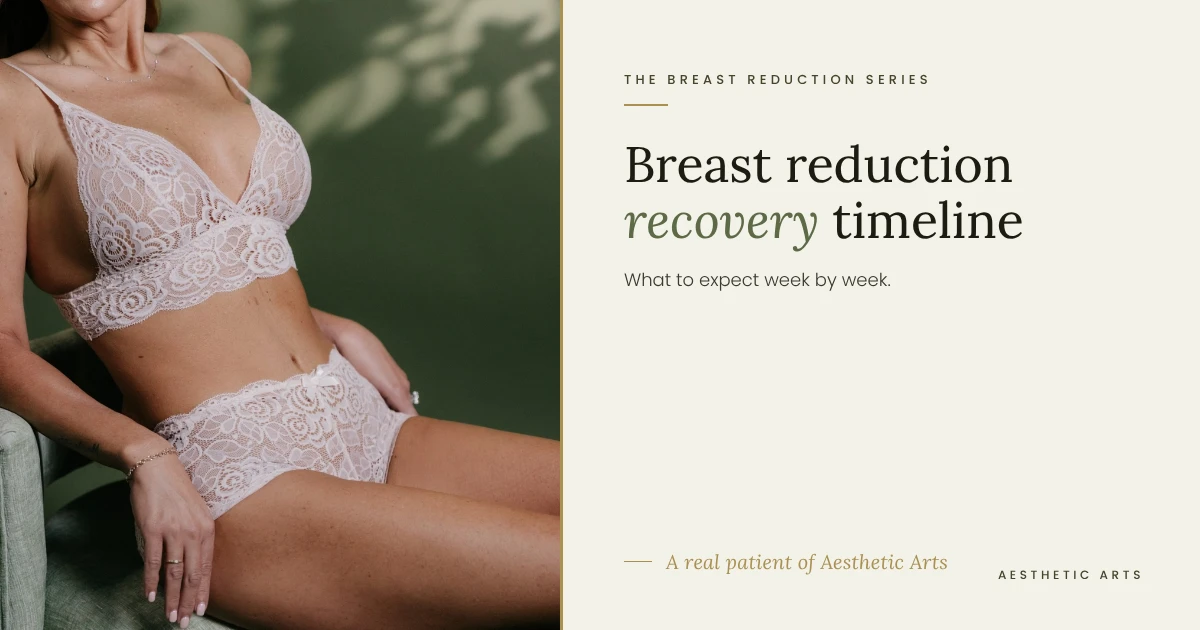 breast reduction recovery, real patient of Aesthetic Arts, Georgia