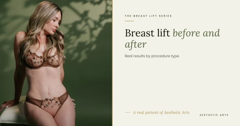 Breast Lift Before and After: Real Results by Procedure