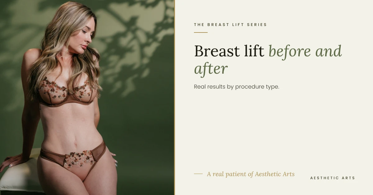 Breast Lift Before and After Real Results by Procedure